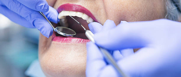 Best Chipped Tooth Repair Near Me  in Needville, TX